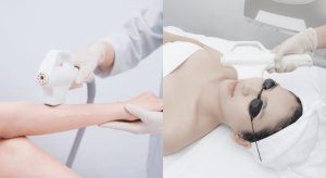 Đầu làm lạnh giúp làm tê nhẹ bề mặt da và giảm nhiệt dư, hạn chế tối đa cảm giác đau rát khi triệt lông.
