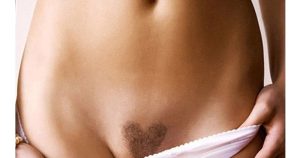 Tạo hình lông vùng kín là phương pháp loại bỏ và định hình lông bikini theo thẩm mỹ cá nhân thay vì chỉ cạo hay wax tạm thời.