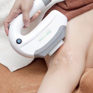 Liệu trình triệt lông OPT SHR có giá dao động từ 1 đến 12 triệu đồng tùy vùng điều trị, tiết kiệm chi phí hơn so với Diode Laser.
