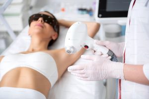 Triệt lông da nhạy cảm bằng công nghệ laser an toàn