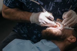 Lông mọc ngược sau triệt lông