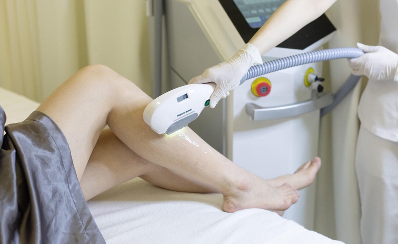 Triệt lông công nghệ cao cần từ 6 đến 12 buổi cách nhau 4–6 tuần, cho kết quả duy trì nhiều năm hoặc lâu dài, đồng thời hỗ trợ se khít lỗ chân lông và sáng da.