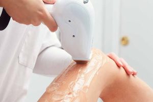 Triệt lông đầu lạnh: cách hoạt động và lợi ích với da nhạy cảm