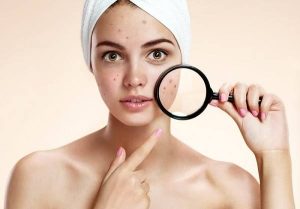 Các bước chuẩn bị làm sạch dịu nhẹ và ngưng dùng mỹ phẩm đặc trị trước khi triệt lông giúp bảo vệ hàng rào da an toàn.