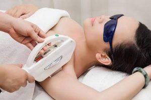 E-Light triệt lông: công nghệ IPL kết hợp RF có tốt không?