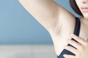 Những lưu ý sau khi triệt lông nách để tránh viêm