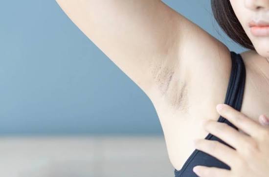 Những lưu ý sau khi triệt lông nách để tránh viêm