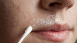 Triệt ria mép vĩnh viễn là phương pháp dùng năng lượng ánh sáng tác động melanin để phá hủy nang lông, ngăn lông tái mọc.