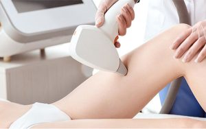 Sắc tố melanin của lông và diện tích vùng da điều trị là những yếu tố chính quyết định số buổi triệt lông laser.