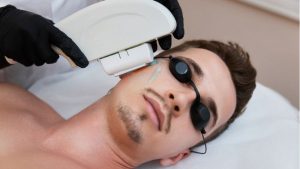 Chuyên viên sẽ thăm khám da và yêu cầu cạo sạch lông bề mặt trước khi thực hiện triệt laser.
