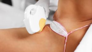Công nghệ Diode Laser cần giãn cách mỗi buổi triệt lông từ 4–8 tuần để nang lông bước vào chu kỳ mới và da hồi phục hoàn toàn, mang lại hiệu quả bền vững lâu dài.