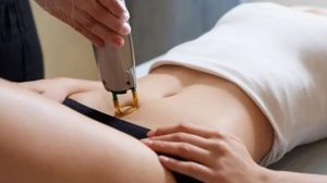 Cần chờ giữa các buổi triệt lông bikini để các nang lông bước vào pha Anagen mới, giúp năng lượng tác động chính xác và đạt hiệu quả tối ưu.