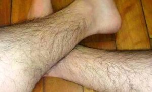 Testosterone và Estrogen chi phối trực tiếp hoạt động nang lông, khiến mật độ và tốc độ mọc lông thay đổi rõ rệt theo giới tính cùng các giai đoạn biến động nội tiết.