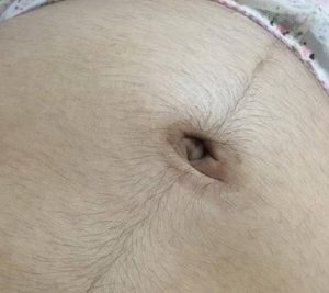 Con gái có đường lông ở bụng thì sao: giải đáp từ chuyên gia
