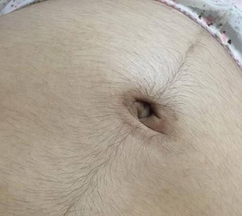 Con gái có đường lông ở bụng thì sao: giải đáp từ chuyên gia