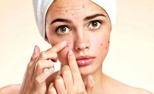 riệt lông mặt bị nổi mụn: nguyên nhân và cách xử lý an toàn