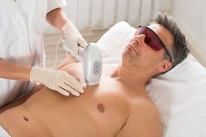 Triệt lông ngực vĩnh viễn: công nghệ Laser nào hiệu quả nhất