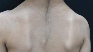 Nhân tướng học coi xoáy lông lưng là "vòng quý tướng", biểu thị người thông minh, kiên định, hào sảng và gặp nhiều may mắn.