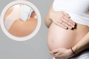 Có bầu triệt lông bikini được không: lời khuyên từ bác sĩ