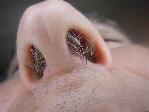 Lông mũi bạc là do đâu? Nguyên nhân và cách chăm sóc
