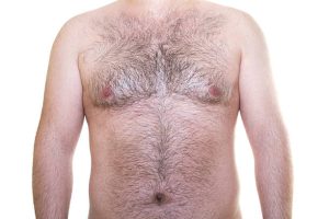 Cạo sạch trước 24 giờ (không nhổ/wax), giữ da mộc, chống nắng kỹ 2–3 tuần và ngưng treatment mạnh (AHA, BHA, retinoids) 1–2 tuần trước buổi triệt để đảm bảo an toàn, tối đa hóa hiệu quả.