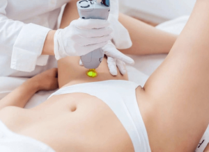 Sau khi triệt lông, cần kiêng quan hệ 24–48 giờ đầu để tránh ma sát gây viêm nang lông và nhiễm khuẩn.