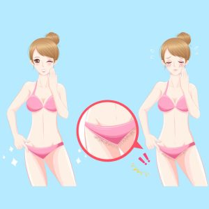 Quy trình triệt lông bikini chuẩn: 7 bước an toàn, không đau