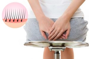 Da hậu môn sẫm màu, nhiều dây thần kinh, luôn ẩm ướt và nhạy cảm nên cần triệt lông đúng kỹ thuật để tránh kích ứng.