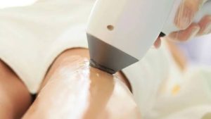 Laser tác động trực tiếp vào gốc nang lông, do đó da cần sạch và lông còn nguyên gốc để tối ưu hiệu quả triệt lông.