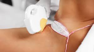Triệt lông bikini là gì: công nghệ, lợi ích, lịch trình